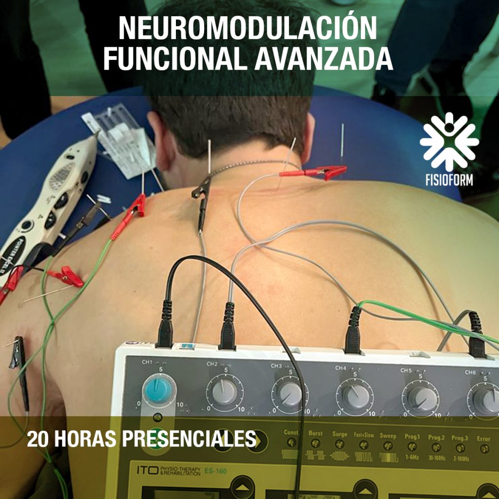 Curso Neuromodulaci N Funcional En Madrid Fisioform Cursos