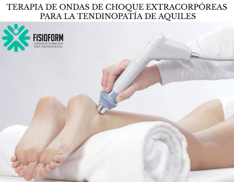 Terapia de ondas de choque extracorpóreas para la tendinopatía de Aquiles FisioForm