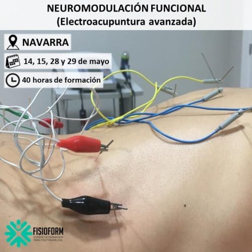 Curso Neuromodulación Funcional Electroacupuntura Avanzada en Navarra