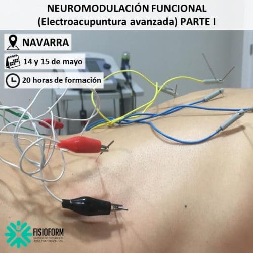 Curso Neuromodulación Funcional Electroacupuntura Avanzada en Navarra