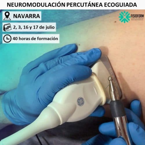 Curso Neuromodulación Percutanea Ecoguiada en Navarra