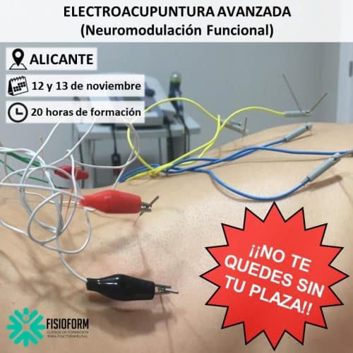 Curso Electroacupuntura Avanzada Alicante