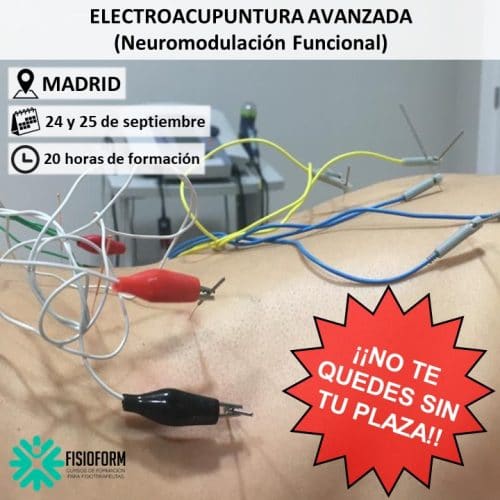 Curso Electroacupuntura Avanzada en Madrid