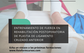 Artículo Ligamento Cruzado Anterior