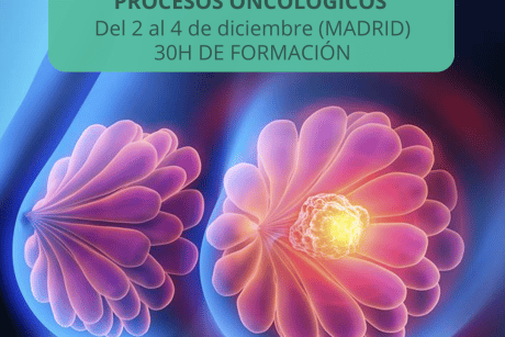 Curso Fisioterapia Oncológica en Madrid