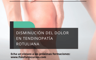 Artículo Dolor Tendinopatía Rotuliana