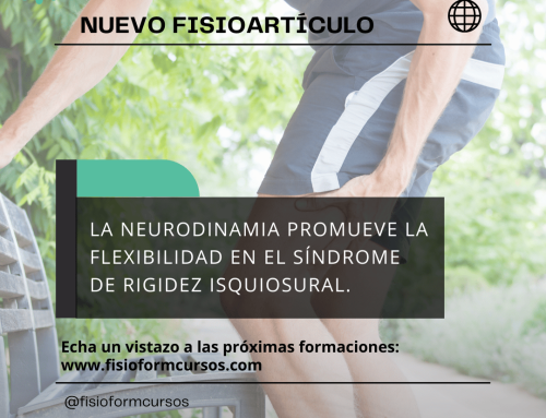 La Neurodinamia promueve la Flexibilidad en el Síndrome de Rigidez Isquiosural