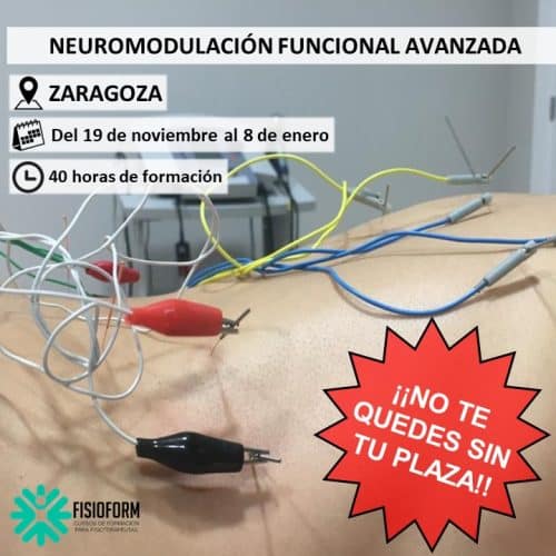 Neuromodulación Funcional Avanzada en Zaragoza
