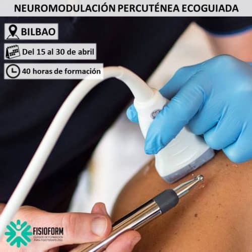Neuromodulación Percutánea Ecoguiada en Bilbao