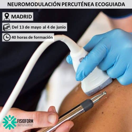 Neuromodulación Percutánea Ecoguiada en Madrid
