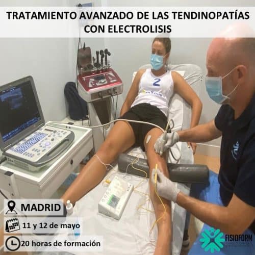 Tratamiento Ecoguiado Tendinopatías con Electrólisis Madrid