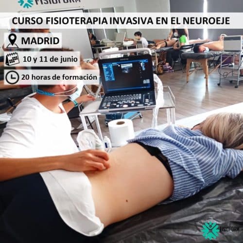Fisioterapia Invasiva en el Neuroeje Madrid