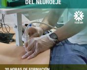 Curso Fisioterapia Invasiva del Neuroeje