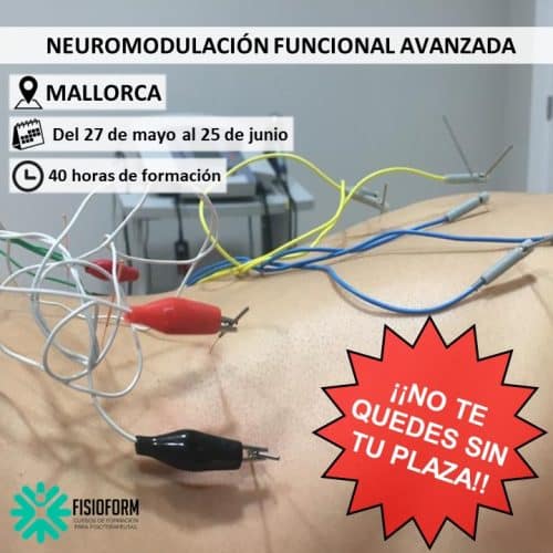 Neuromodulación Funcional Avanzada en Mallorca