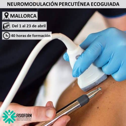 Neuromodulación Percutánea Ecoguiada en Mallorca