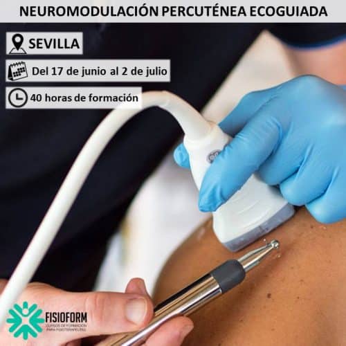 Neuromodulación Percutánea Ecoguiada en Sevilla
