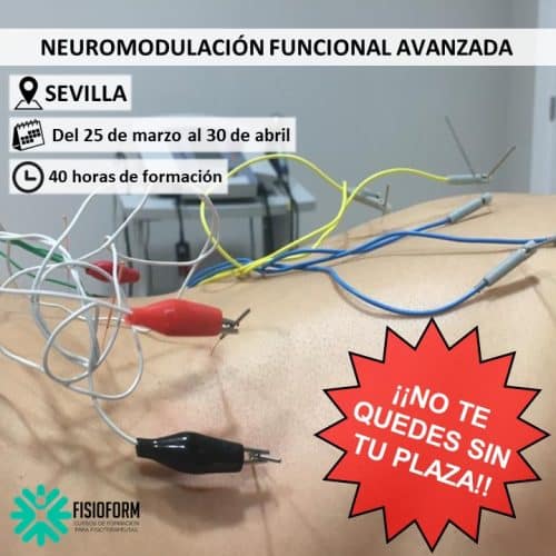 Neuromodulación Funcional Avanzada en Sevilla