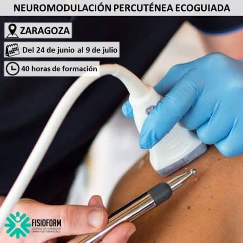 Neuromodulación Percutánea Ecoguiada en Zaragoza