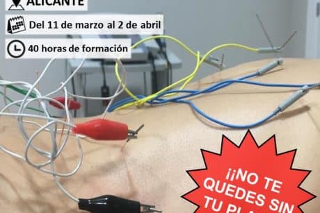 Neuromodulación Funcional Avanzada en Alicante