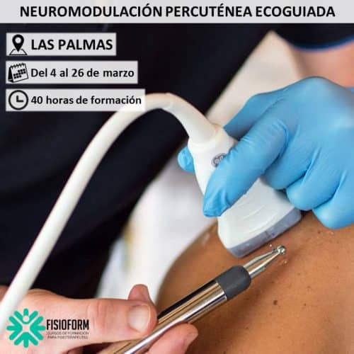 Neuromodulación Percutánea Ecoguiada en Las Palmas