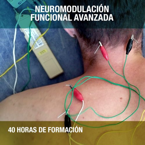 Neuromodulación Funcional Avanzada Barcelona