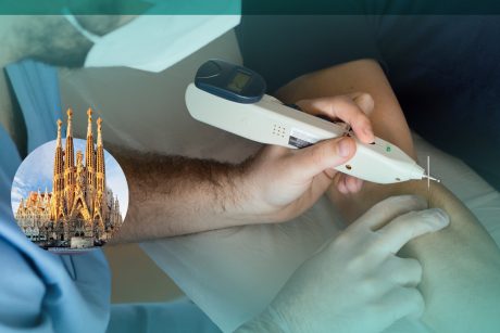 Formación en Fisioterapia Invasiva y ecografía Barcelona