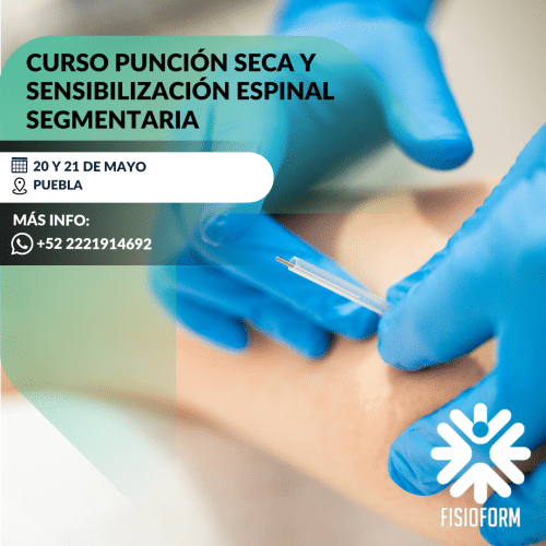 Punción Seca y Sensibilización Espinal Segmentaria