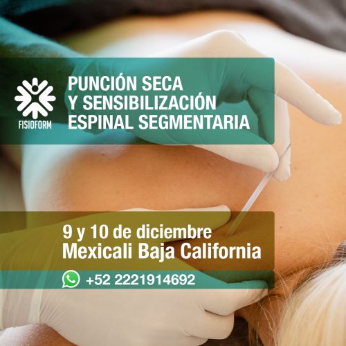 Curso de Punción Seca y Sensibilización Espinal Segmentaria - Mexicali Baja California