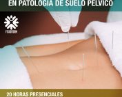 Fisioterapia Invasiva en patología de Suelo Pélvico