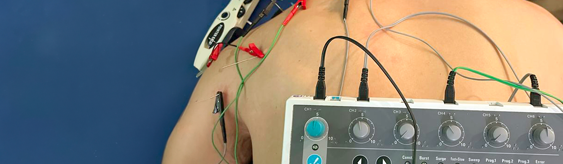 Formación para Fisioterapeutas - Neuromodulación
